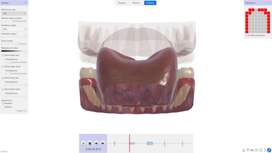 3D tongue rear view