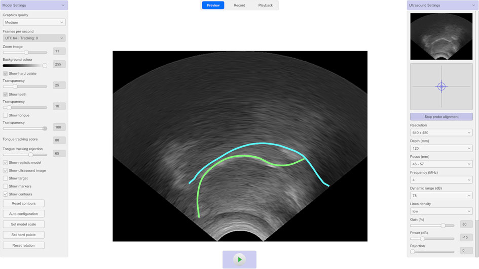 LinguaSound 3D tongue contour overlays
