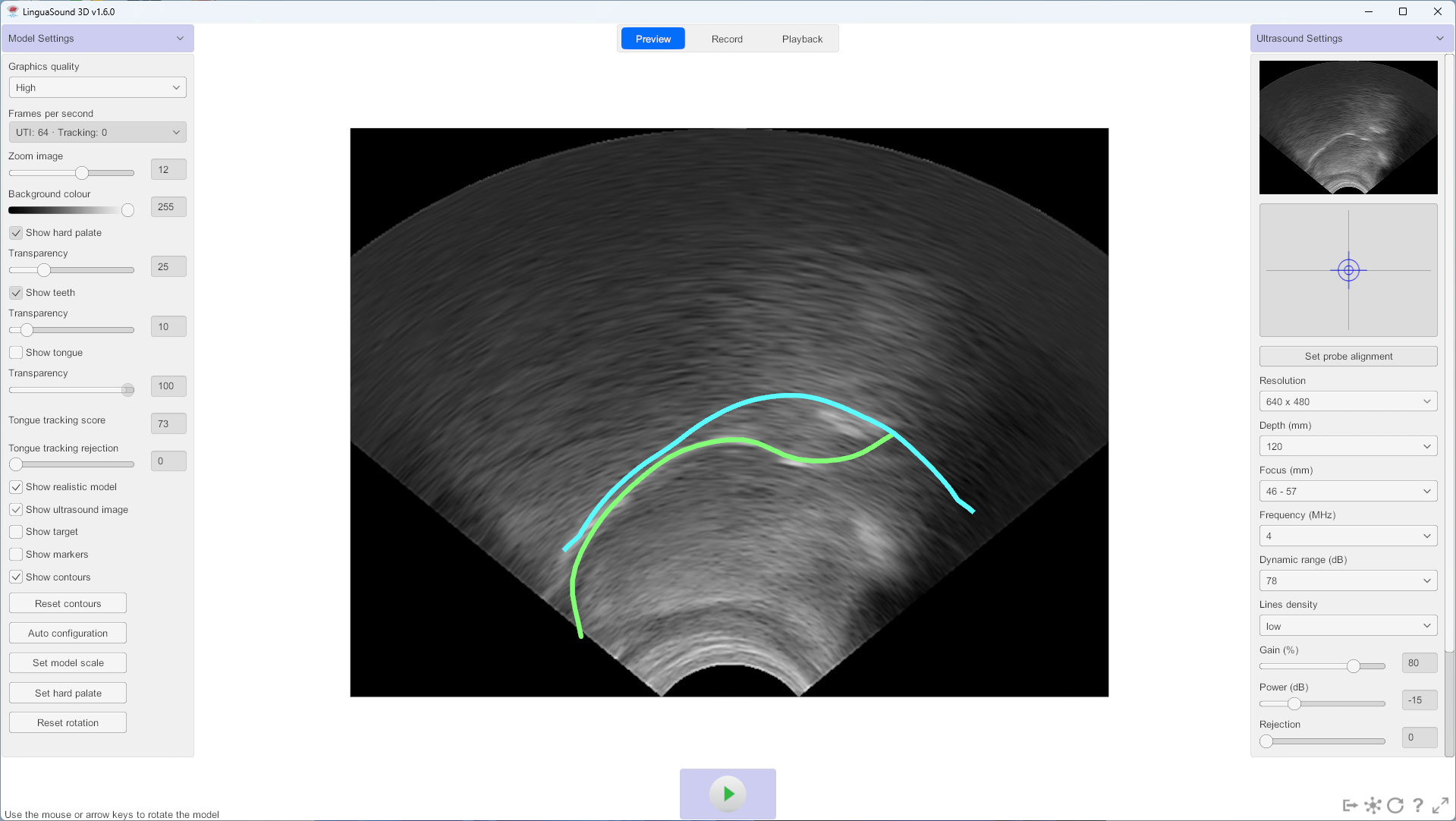 Ultrasound tongue imaging contour overlays