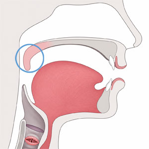 Diagram of the speech anatomy with the soft palate (velum) highlighted