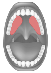 Tongue palate contact for /ʃ/ and /ʒ/