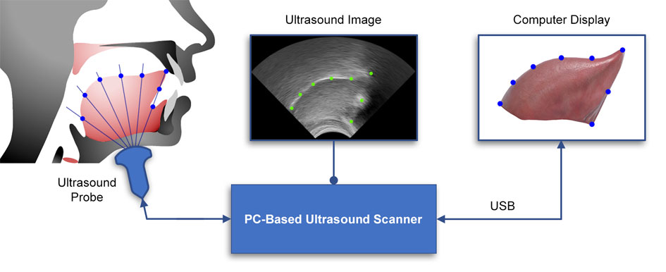How enhanced ultrasound tongue imaging works