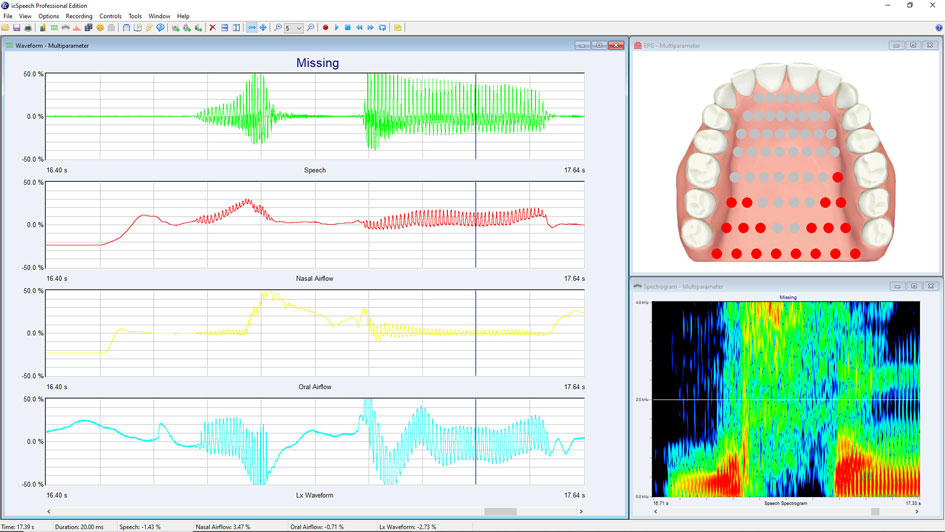 Electropalatography software • speech, EGG, nasal and oral airflow waveforms, spectrogram and palatograph displays.