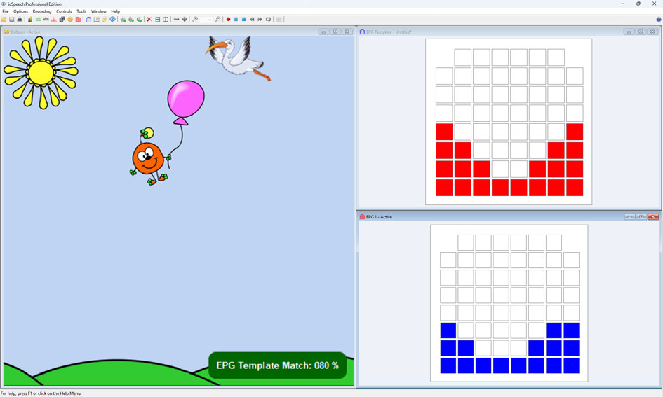 icSpeech Professional Edition — EPG template matching biofeedback game showing live tongue-palate contact against target pattern with 80% match score