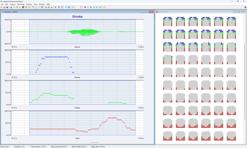 icSpeech Professional Edition — lingual parameter waveforms showing alveolar, palatal and velar contact with EPG palatograph sequence