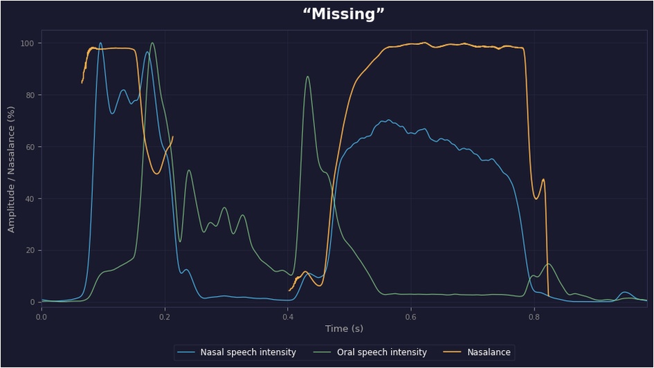 Nasalance waveform showing nasal speech intensity, oral speech intensity and nasalance exported from icSpeech Professional Edition