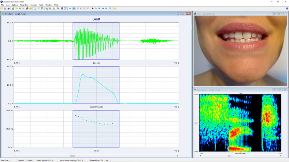 icSpeech Standard Edition • speech, voice intensity and pitch waveforms, spectrogram and video of the mouth.