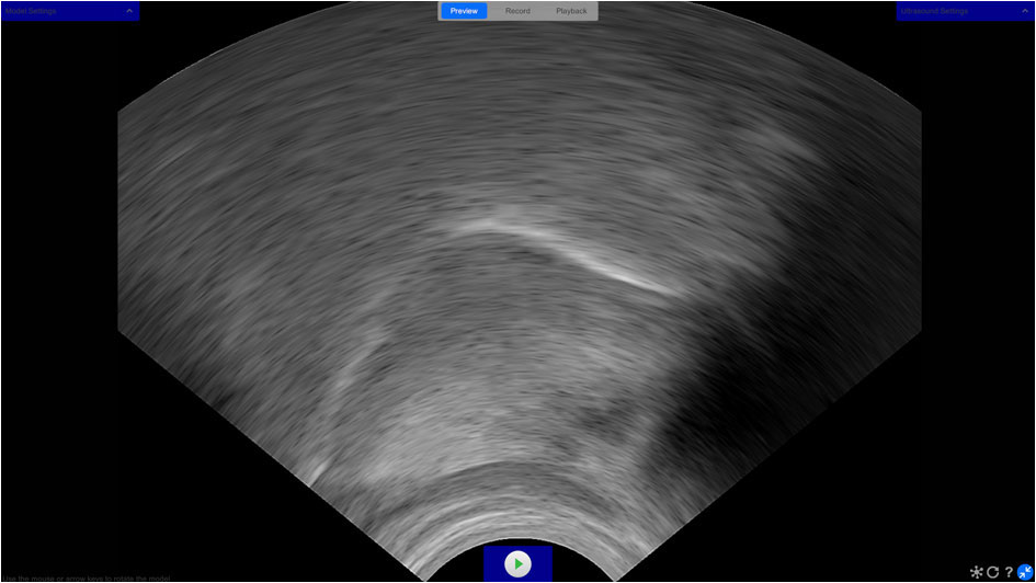 Conventional ultrasound tongue imaging greyscale image without 3D visualisation