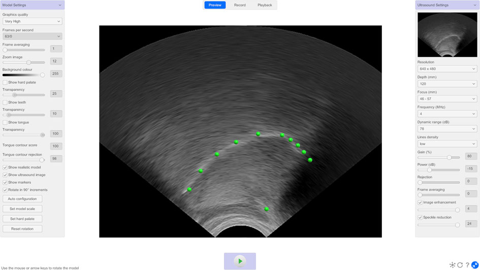 LinguaSound 3D tongue surface contour estimation markers overlaid on live ultrasound image