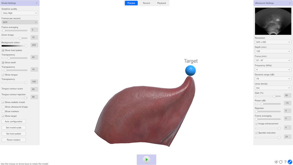 LinguaSound 3D tongue model showing adjustable target marker for speech biofeedback