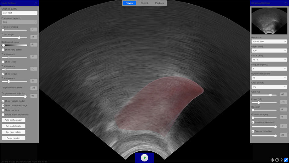LinguaSound 3D tongue model overlaid on live ultrasound image allowing direct comparison of model accuracy