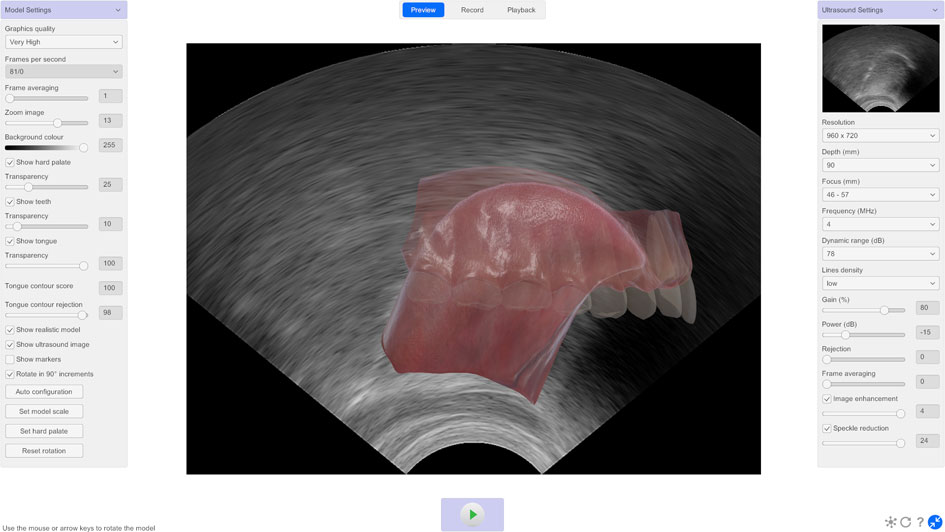 LinguaSound 3D software interface showing 3D tongue model overlaid on live ultrasound image