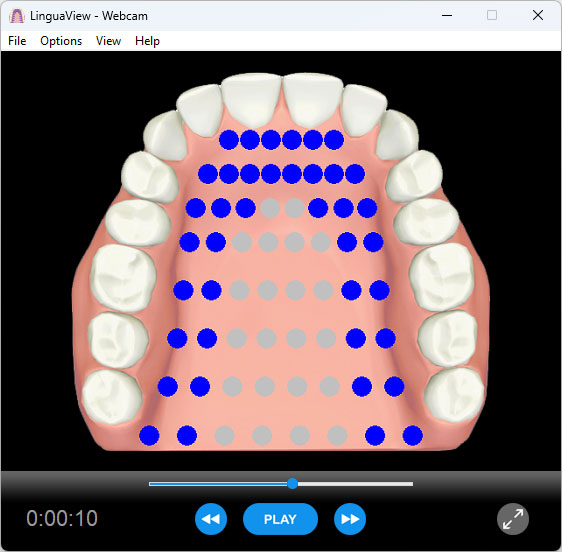LinguaView electropalatography software — anatomical palatograph display