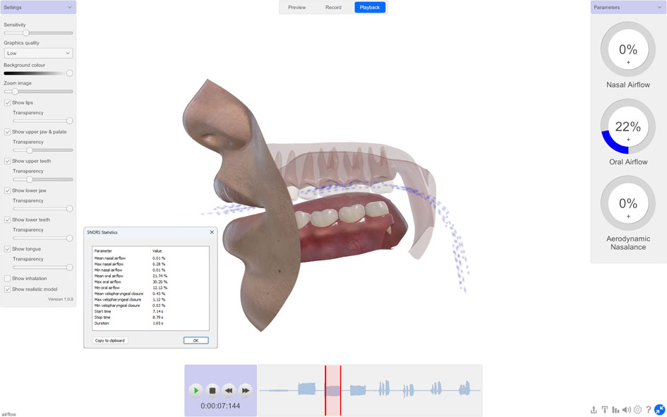 SNORS 3D statistics panel showing mean and maximum nasal airflow, oral airflow, and aerodynamic nasalance values from a recorded speech sample