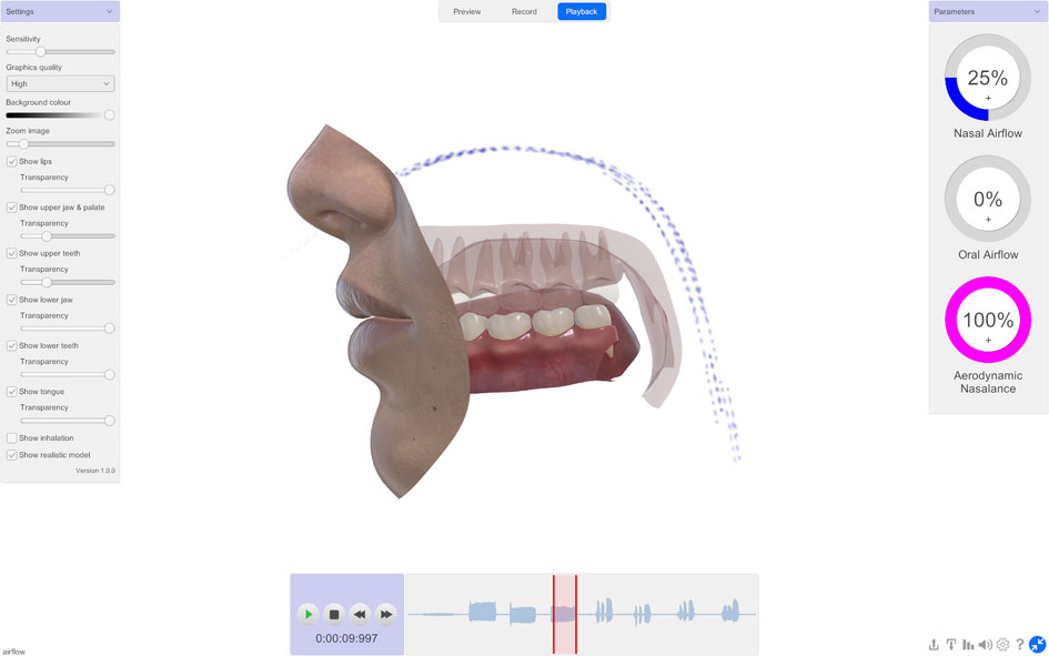 SNORS 3D lateral view showing 100% aerodynamic nasalance and nasal airflow during playback — velopharyngeal closure measurement