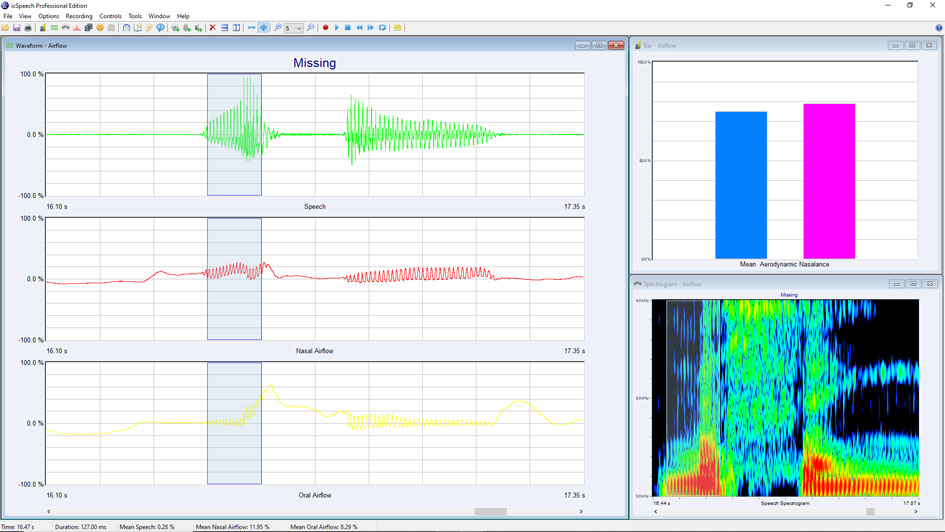 icSpeech Professional Edition displaying nasal airflow, oral airflow and speech waveforms with spectrogram during SNORS measurement
