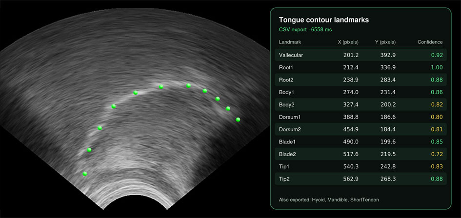 Tongue contour landmarks exported to CSV, shown beside the ultrasound image with the estimated tongue contour overlaid