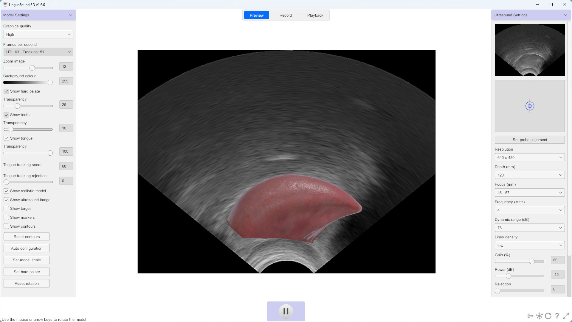 LinguaSound 3D probe alignment tool