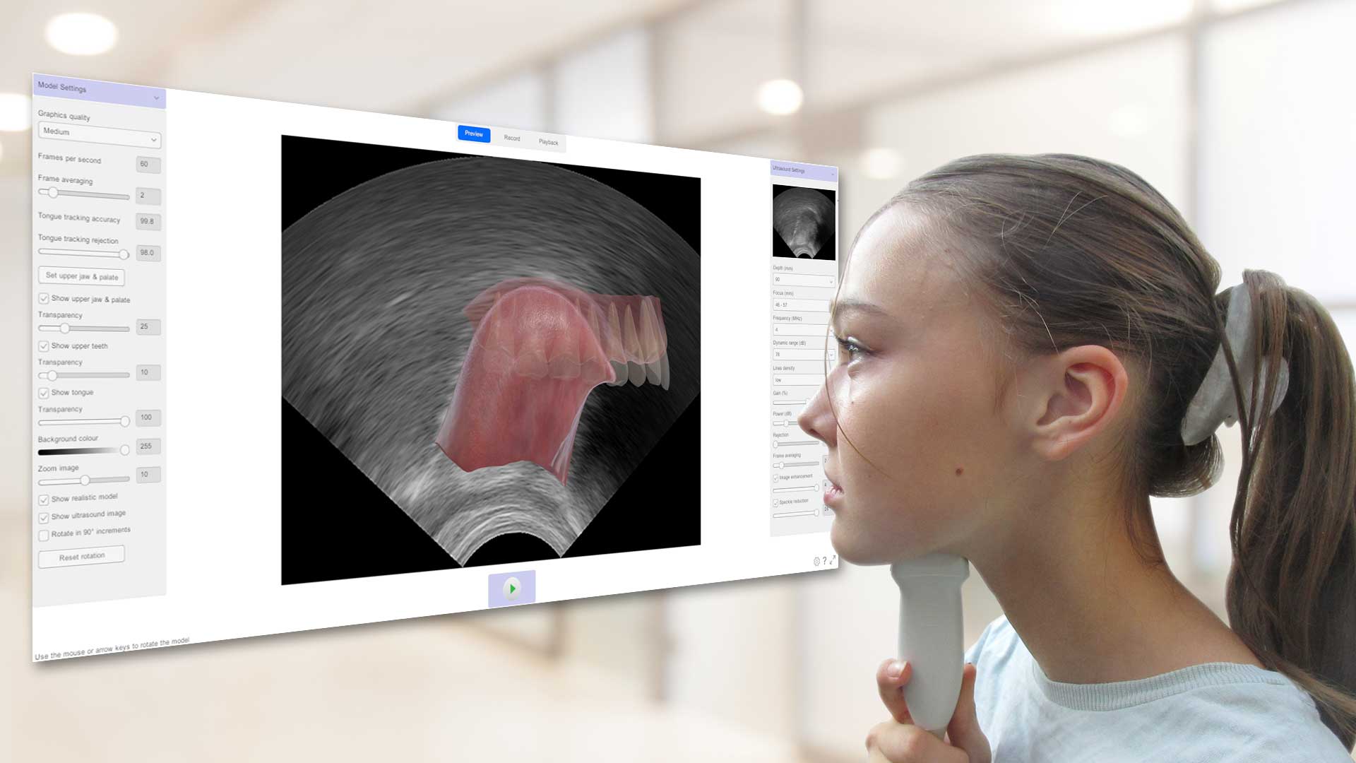 Ultrasound tongue imaging