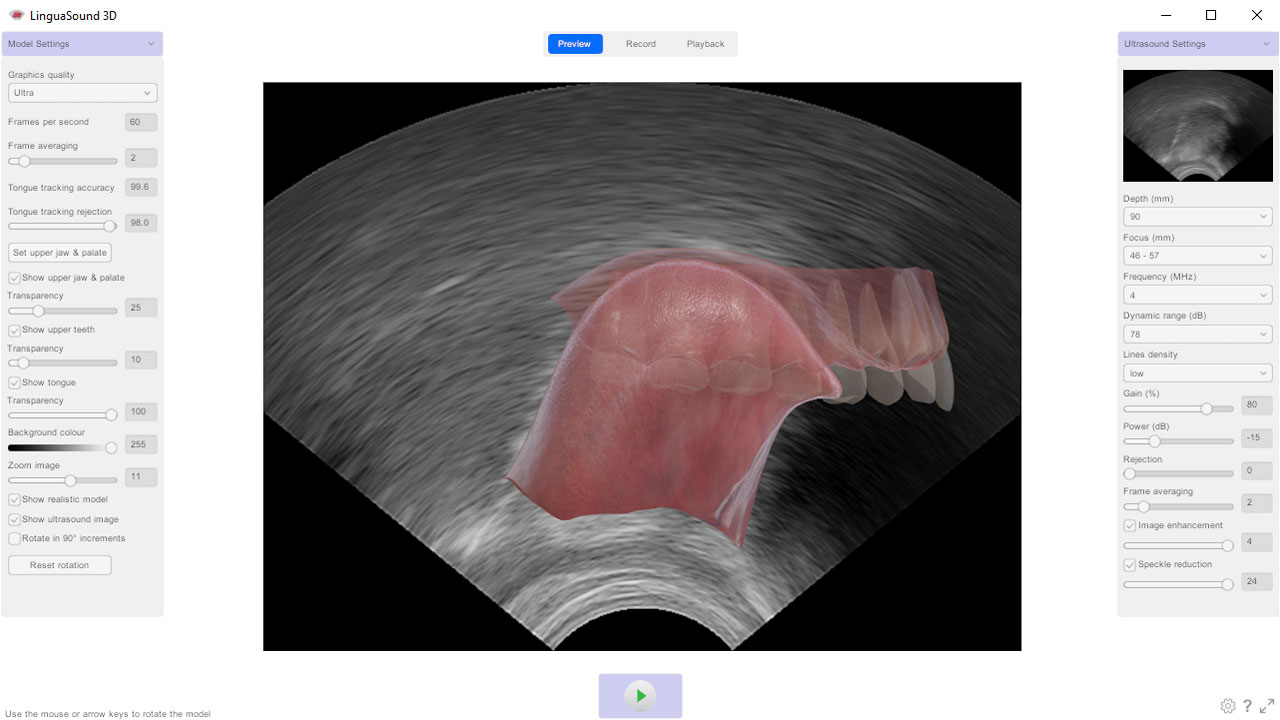 Ultrasound Tongue Imaging (UTI)